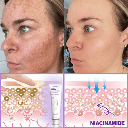𝐃𝐞𝐫𝐦𝐚𝐭𝐨𝐥𝐨𝐠𝐢𝐬𝐭-𝐑𝐞𝐜𝐨𝐦𝐦𝐞𝐧𝐝𝐞𝐝 👩‍⚕️|💎 𝑽𝒊𝙩𝙖l𝗶𝘀𝐲𝐬® 𝙋𝘿𝙍𝙉 𝙈𝙪𝙡𝙩𝙞-𝙋𝙚𝙥𝙩𝙞𝙙𝙚 𝑴𝒂𝒔𝒔𝒂𝒈𝒊𝒏𝒈 𝑩𝒐𝒅𝒚 𝑹𝒐𝒍𝒍𝒆𝒓 𝑪𝒓𝒆𝒂𝒎- 𝑨𝒏𝒕𝒊-𝒂𝒈𝒊𝒏𝒈, 𝐇𝐲𝐝𝐫𝐚𝐭𝐢𝐧𝐠, 𝐒𝐤𝐢𝐧 𝐅𝐢𝐫𝐦𝐢𝐧𝐠 & 𝐋𝐢𝐟𝐭𝐢𝐧𝐠, 𝗦𝗸𝗶𝗻 𝗥𝗲𝗽𝗮𝗶𝗿, 𝗘𝘃𝗲𝗻 𝗧𝗼𝗻𝗲, 𝗔𝗰𝗻𝗲 𝗮𝗻𝗱 𝗗𝗮𝗿𝗸 𝗦𝗽𝗼𝘁 𝗧𝗿𝗲𝗮𝘁𝗺𝗲𝗻𝘁, 𝗪𝗮𝗿𝘁 𝗮𝗻𝗱 𝗠𝗼𝗹𝗲 𝗥𝗲𝗺𝗼𝘃𝗮𝗹, 𝗮𝗻𝗱 𝗣𝘀𝗼𝗿𝗶𝗮𝘀𝗶𝘀 𝗥𝗲𝗹𝗶𝗲𝗳.