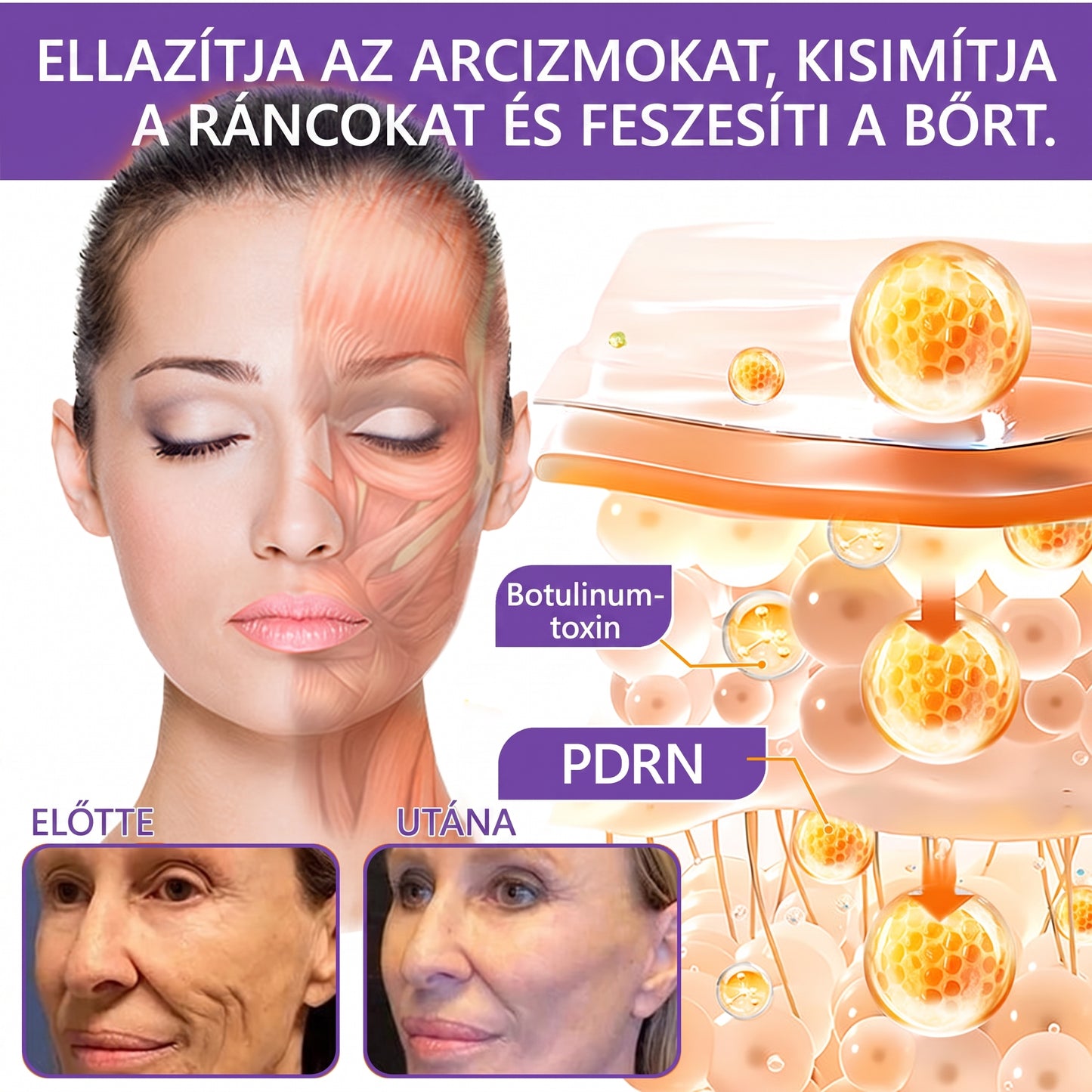 Bőrgyógyászok által ajánlott👩‍⚕️ |🥇 Vitalisys® PDRN Multi-Peptide Masszírozó Testápoló Krém – Öregedésgátló, hidratáló, feszesítő, bőrregeneráló, egységesítő, pattanás- és folteltávolító, szemölcs- és anyajegy-eltávolító, pikkelysömör enyhítő.🍇
