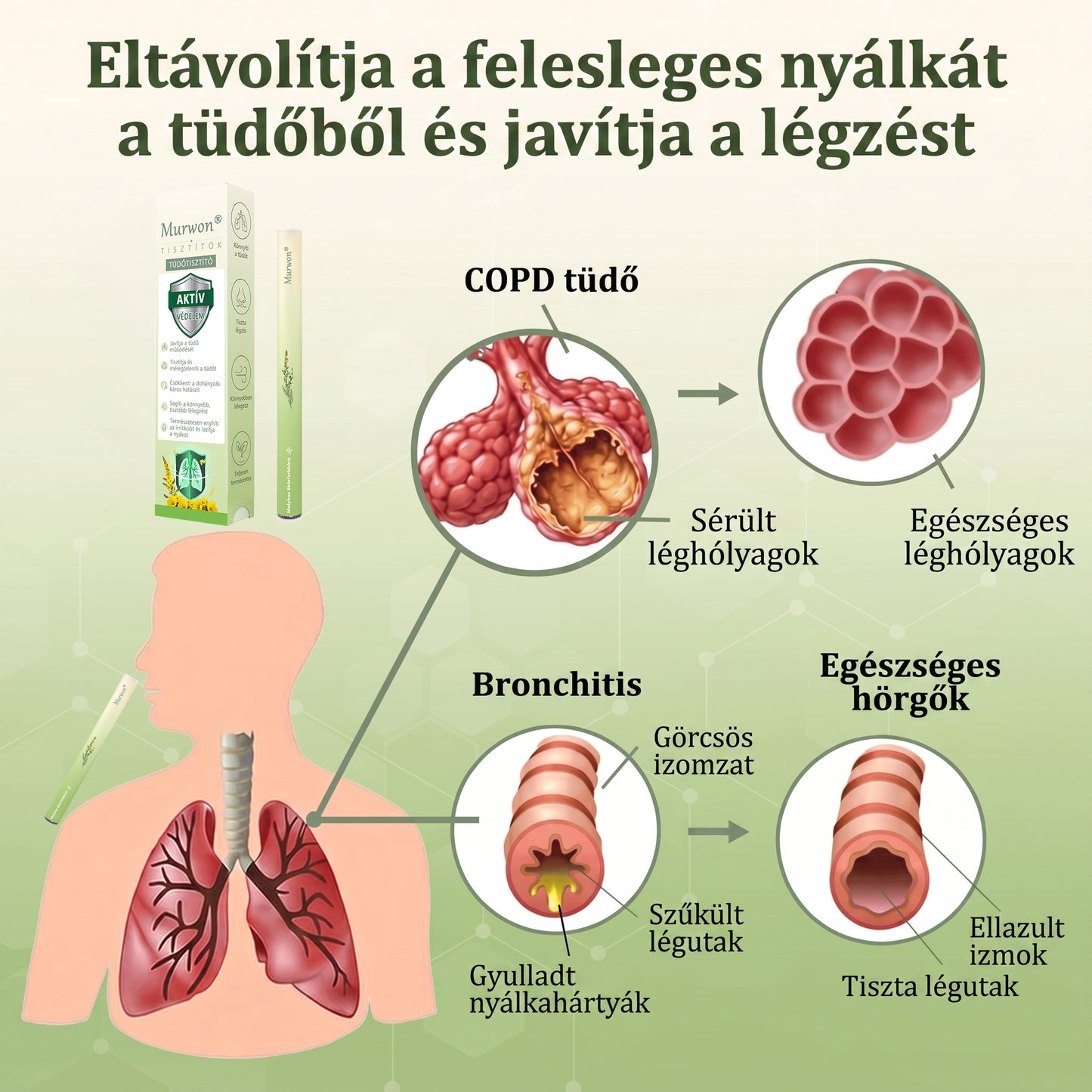 🇭🇺 𝐇𝐢𝐯𝐚𝐭𝐚𝐥𝐨𝐬 𝐖𝐞𝐛á𝐫𝐮𝐡á𝐳✅ 𝑀𝐮𝒓𝒘𝒐𝒏® gyógynövényes tüdőtisztító párologtató👑(👨‍⚕️Hatékony segítség: köhögés, torokgyulladás, légszomj, váladékképződés, orrdugulás, hörghurut, allergiás tünetek és tüdőpanaszok esetén)2💝