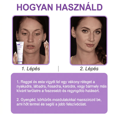 Bőrgyógyászok által ajánlott👩‍⚕️ |🥇 Vitalisys® PDRN Multi-Peptide Masszírozó Testápoló Krém – Öregedésgátló, hidratáló, feszesítő, bőrregeneráló, egységesítő, pattanás- és folteltávolító, szemölcs- és anyajegy-eltávolító, pikkelysömör enyhítő.🍇