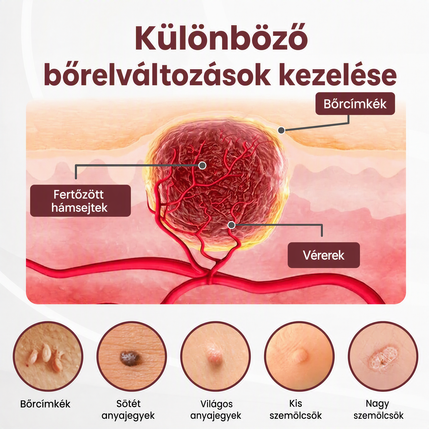Autoryzowany sklep flagowy 🌿|🌥️ Vitalisys® 7-dniowy korektor do usuwania znamion i plam (rolka do usuwania bez bólu i bez blizn) 💟