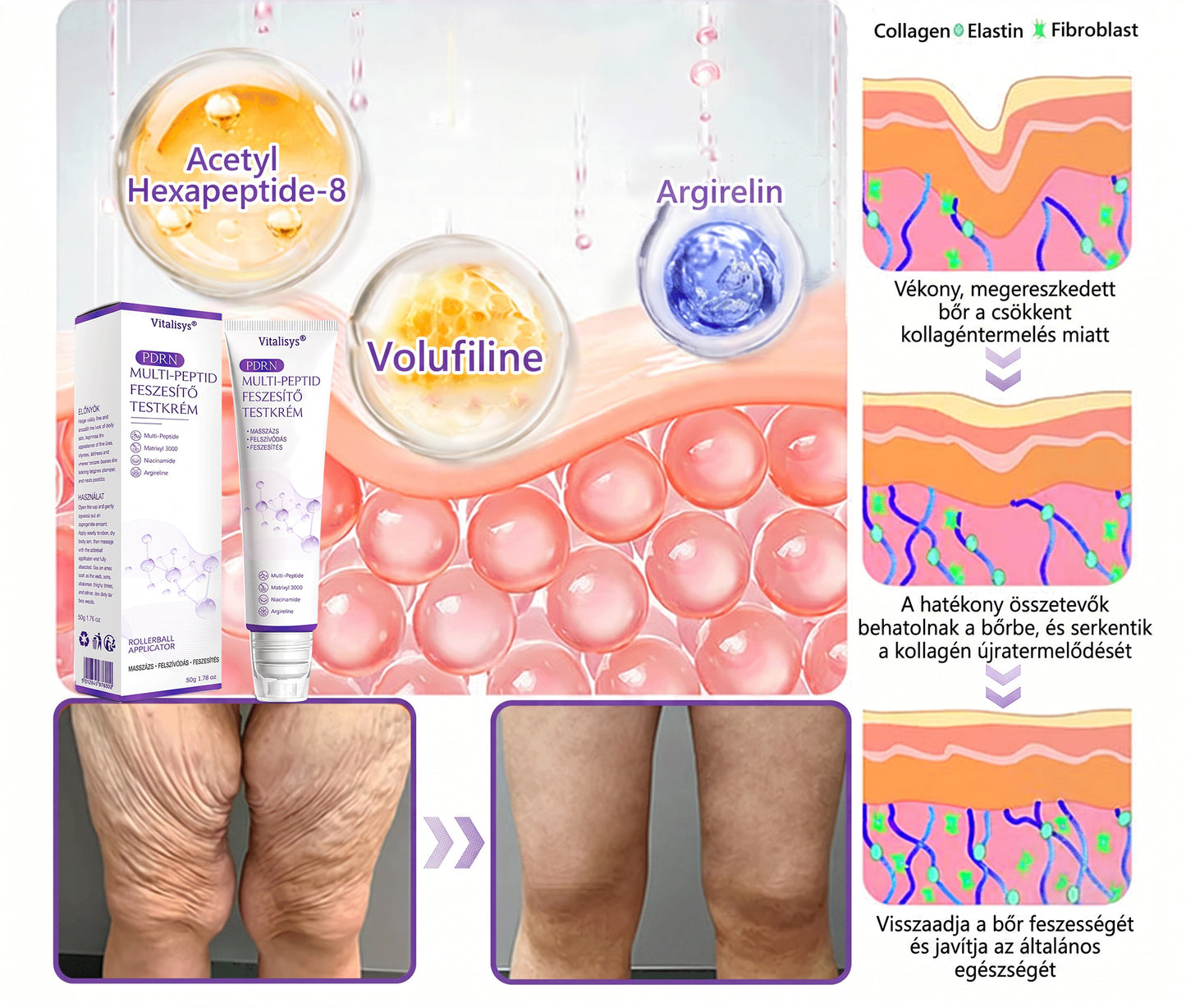 Bőrgyógyászok által ajánlott👩‍⚕️ |🥇 Vitalisys® PDRN Multi-Peptide Masszírozó Testápoló Krém – Öregedésgátló, hidratáló, feszesítő, bőrregeneráló, egységesítő, pattanás- és folteltávolító, szemölcs- és anyajegy-eltávolító, pikkelysömör enyhítő.🍇
