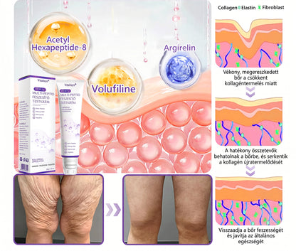 Bőrgyógyászok által ajánlott👩‍⚕️ |🥇 Vitalisys® PDRN Multi-Peptide Masszírozó Testápoló Krém – Öregedésgátló, hidratáló, feszesítő, bőrregeneráló, egységesítő, pattanás- és folteltávolító, szemölcs- és anyajegy-eltávolító, pikkelysömör enyhítő.🍇