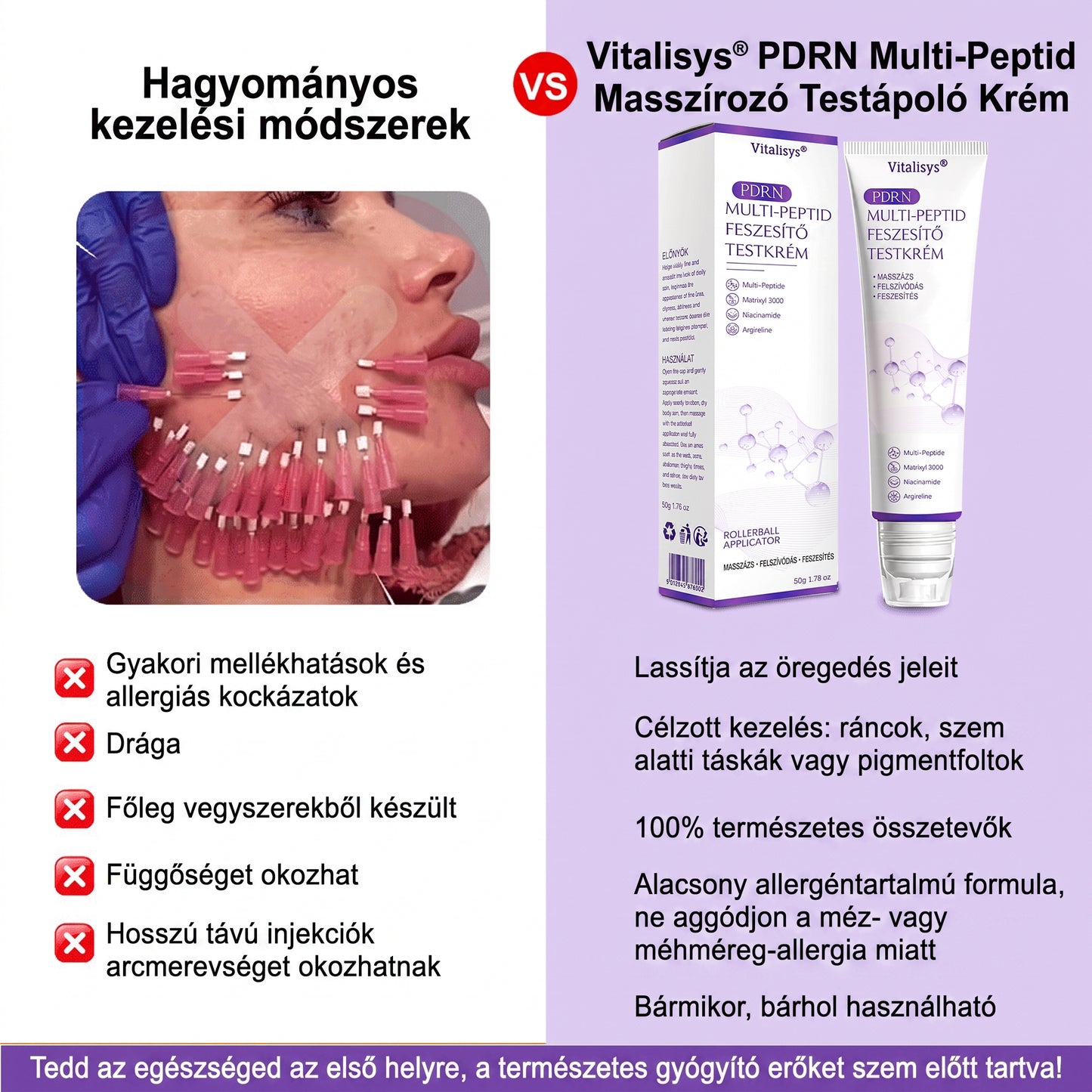 Bőrgyógyászok által ajánlott👩‍⚕️ |🥇 Vitalisys® PDRN Multi-Peptide Masszírozó Testápoló Krém – Öregedésgátló, hidratáló, feszesítő, bőrregeneráló, egységesítő, pattanás- és folteltávolító, szemölcs- és anyajegy-eltávolító, pikkelysömör enyhítő.🍇