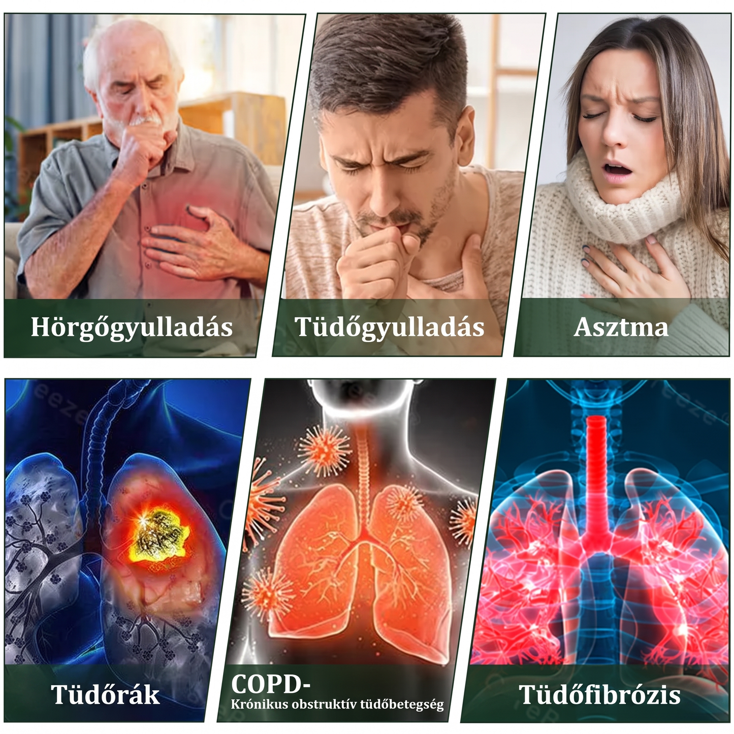🇭🇺 𝐇𝐢𝐯𝐚𝐭𝐚𝐥𝐨𝐬 𝐖𝐞𝐛á𝐫𝐮𝐡á𝐳✅ 𝑀𝐮𝒓𝒘𝒐𝒏® gyógynövényes tüdőtisztító párologtató👑(👨‍⚕️Hatékony segítség: köhögés, torokgyulladás, légszomj, váladékképződés, orrdugulás, hörghurut, allergiás tünetek és tüdőpanaszok esetén)2💝