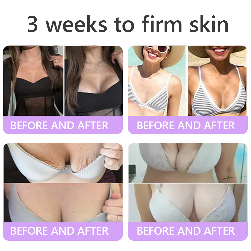 𝐃𝐞𝐫𝐦𝐚𝐭𝐨𝐥𝐨𝐠𝐢𝐬𝐭-𝐑𝐞𝐜𝐨𝐦𝐦𝐞𝐧𝐝𝐞𝐝 👩‍⚕️|💎 𝑽𝒊𝙩𝙖l𝗶𝘀𝐲𝐬® 𝙋𝘿𝙍𝙉 𝙈𝙪𝙡𝙩𝙞-𝙋𝙚𝙥𝙩𝙞𝙙𝙚 𝑴𝒂𝒔𝒔𝒂𝒈𝒊𝒏𝒈 𝑩𝒐𝒅𝒚 𝑹𝒐𝒍𝒍𝒆𝒓 𝑪𝒓𝒆𝒂𝒎- 𝑨𝒏𝒕𝒊-𝒂𝒈𝒊𝒏𝒈, 𝐇𝐲𝐝𝐫𝐚𝐭𝐢𝐧𝐠, 𝐒𝐤𝐢𝐧 𝐅𝐢𝐫𝐦𝐢𝐧𝐠 & 𝐋𝐢𝐟𝐭𝐢𝐧𝐠, 𝗦𝗸𝗶𝗻 𝗥𝗲𝗽𝗮𝗶𝗿, 𝗘𝘃𝗲𝗻 𝗧𝗼𝗻𝗲, 𝗔𝗰𝗻𝗲 𝗮𝗻𝗱 𝗗𝗮𝗿𝗸 𝗦𝗽𝗼𝘁 𝗧𝗿𝗲𝗮𝘁𝗺𝗲𝗻𝘁, 𝗪𝗮𝗿𝘁 𝗮𝗻𝗱 𝗠𝗼𝗹𝗲 𝗥𝗲𝗺𝗼𝘃𝗮𝗹, 𝗮𝗻𝗱 𝗣𝘀𝗼𝗿𝗶𝗮𝘀𝗶𝘀 𝗥𝗲𝗹𝗶𝗲𝗳.
