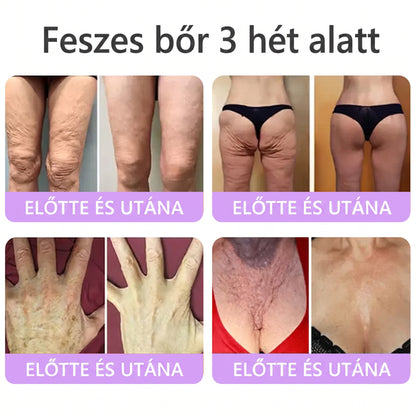 Bőrgyógyászok által ajánlott👩‍⚕️ |🥇 Vitalisys® PDRN Multi-Peptide Masszírozó Testápoló Krém – Öregedésgátló, hidratáló, feszesítő, bőrregeneráló, egységesítő, pattanás- és folteltávolító, szemölcs- és anyajegy-eltávolító, pikkelysömör enyhítő.🍇