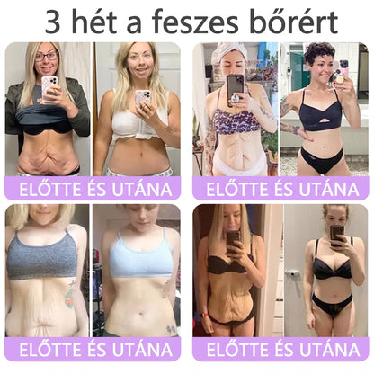 Bőrgyógyászok által ajánlott👩‍⚕️ |🥇 Vitalisys® PDRN Multi-Peptide Masszírozó Testápoló Krém – Öregedésgátló, hidratáló, feszesítő, bőrregeneráló, egységesítő, pattanás- és folteltávolító, szemölcs- és anyajegy-eltávolító, pikkelysömör enyhítő.🍇