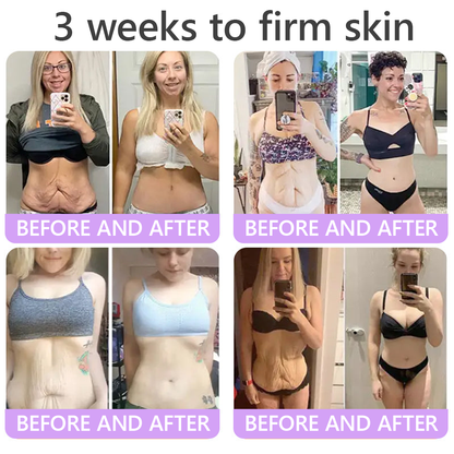 𝐃𝐞𝐫𝐦𝐚𝐭𝐨𝐥𝐨𝐠𝐢𝐬𝐭-𝐑𝐞𝐜𝐨𝐦𝐦𝐞𝐧𝐝𝐞𝐝 👩‍⚕️|💎 𝑽𝒊𝙩𝙖l𝗶𝘀𝐲𝐬® 𝙋𝘿𝙍𝙉 𝙈𝙪𝙡𝙩𝙞-𝙋𝙚𝙥𝙩𝙞𝙙𝙚 𝑴𝒂𝒔𝒔𝒂𝒈𝒊𝒏𝒈 𝑩𝒐𝒅𝒚 𝑹𝒐𝒍𝒍𝒆𝒓 𝑪𝒓𝒆𝒂𝒎- 𝑨𝒏𝒕𝒊-𝒂𝒈𝒊𝒏𝒈, 𝐇𝐲𝐝𝐫𝐚𝐭𝐢𝐧𝐠, 𝐒𝐤𝐢𝐧 𝐅𝐢𝐫𝐦𝐢𝐧𝐠 & 𝐋𝐢𝐟𝐭𝐢𝐧𝐠, 𝗦𝗸𝗶𝗻 𝗥𝗲𝗽𝗮𝗶𝗿, 𝗘𝘃𝗲𝗻 𝗧𝗼𝗻𝗲, 𝗔𝗰𝗻𝗲 𝗮𝗻𝗱 𝗗𝗮𝗿𝗸 𝗦𝗽𝗼𝘁 𝗧𝗿𝗲𝗮𝘁𝗺𝗲𝗻𝘁, 𝗪𝗮𝗿𝘁 𝗮𝗻𝗱 𝗠𝗼𝗹𝗲 𝗥𝗲𝗺𝗼𝘃𝗮𝗹, 𝗮𝗻𝗱 𝗣𝘀𝗼𝗿𝗶𝗮𝘀𝗶𝘀 𝗥𝗲𝗹𝗶𝗲𝗳.