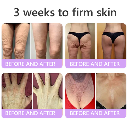 𝐃𝐞𝐫𝐦𝐚𝐭𝐨𝐥𝐨𝐠𝐢𝐬𝐭-𝐑𝐞𝐜𝐨𝐦𝐦𝐞𝐧𝐝𝐞𝐝 👩‍⚕️|💎 𝑽𝒊𝙩𝙖l𝗶𝘀𝐲𝐬® 𝙋𝘿𝙍𝙉 𝙈𝙪𝙡𝙩𝙞-𝙋𝙚𝙥𝙩𝙞𝙙𝙚 𝑴𝒂𝒔𝒔𝒂𝒈𝒊𝒏𝒈 𝑩𝒐𝒅𝒚 𝑹𝒐𝒍𝒍𝒆𝒓 𝑪𝒓𝒆𝒂𝒎- 𝑨𝒏𝒕𝒊-𝒂𝒈𝒊𝒏𝒈, 𝐇𝐲𝐝𝐫𝐚𝐭𝐢𝐧𝐠, 𝐒𝐤𝐢𝐧 𝐅𝐢𝐫𝐦𝐢𝐧𝐠 & 𝐋𝐢𝐟𝐭𝐢𝐧𝐠, 𝗦𝗸𝗶𝗻 𝗥𝗲𝗽𝗮𝗶𝗿, 𝗘𝘃𝗲𝗻 𝗧𝗼𝗻𝗲, 𝗔𝗰𝗻𝗲 𝗮𝗻𝗱 𝗗𝗮𝗿𝗸 𝗦𝗽𝗼𝘁 𝗧𝗿𝗲𝗮𝘁𝗺𝗲𝗻𝘁, 𝗪𝗮𝗿𝘁 𝗮𝗻𝗱 𝗠𝗼𝗹𝗲 𝗥𝗲𝗺𝗼𝘃𝗮𝗹, 𝗮𝗻𝗱 𝗣𝘀𝗼𝗿𝗶𝗮𝘀𝗶𝘀 𝗥𝗲𝗹𝗶𝗲𝗳.