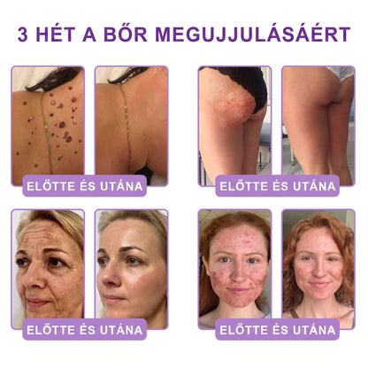 Bőrgyógyászok által ajánlott👩‍⚕️ |🥇 Vitalisys® PDRN Multi-Peptide Masszírozó Testápoló Krém – Öregedésgátló, hidratáló, feszesítő, bőrregeneráló, egységesítő, pattanás- és folteltávolító, szemölcs- és anyajegy-eltávolító, pikkelysömör enyhítő.🍇