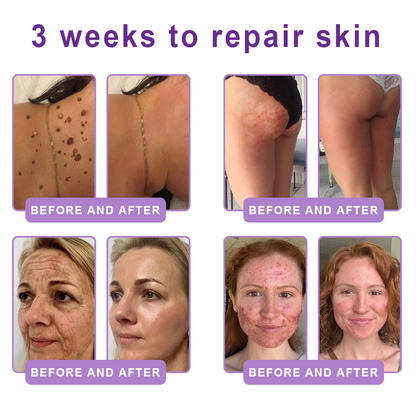 𝐃𝐞𝐫𝐦𝐚𝐭𝐨𝐥𝐨𝐠𝐢𝐬𝐭-𝐑𝐞𝐜𝐨𝐦𝐦𝐞𝐧𝐝𝐞𝐝 👩‍⚕️|💎 𝑽𝒊𝙩𝙖l𝗶𝘀𝐲𝐬® 𝙋𝘿𝙍𝙉 𝙈𝙪𝙡𝙩𝙞-𝙋𝙚𝙥𝙩𝙞𝙙𝙚 𝑴𝒂𝒔𝒔𝒂𝒈𝒊𝒏𝒈 𝑩𝒐𝒅𝒚 𝑹𝒐𝒍𝒍𝒆𝒓 𝑪𝒓𝒆𝒂𝒎- 𝑨𝒏𝒕𝒊-𝒂𝒈𝒊𝒏𝒈, 𝐇𝐲𝐝𝐫𝐚𝐭𝐢𝐧𝐠, 𝐒𝐤𝐢𝐧 𝐅𝐢𝐫𝐦𝐢𝐧𝐠 & 𝐋𝐢𝐟𝐭𝐢𝐧𝐠, 𝗦𝗸𝗶𝗻 𝗥𝗲𝗽𝗮𝗶𝗿, 𝗘𝘃𝗲𝗻 𝗧𝗼𝗻𝗲, 𝗔𝗰𝗻𝗲 𝗮𝗻𝗱 𝗗𝗮𝗿𝗸 𝗦𝗽𝗼𝘁 𝗧𝗿𝗲𝗮𝘁𝗺𝗲𝗻𝘁, 𝗪𝗮𝗿𝘁 𝗮𝗻𝗱 𝗠𝗼𝗹𝗲 𝗥𝗲𝗺𝗼𝘃𝗮𝗹, 𝗮𝗻𝗱 𝗣𝘀𝗼𝗿𝗶𝗮𝘀𝗶𝘀 𝗥𝗲𝗹𝗶𝗲𝗳.