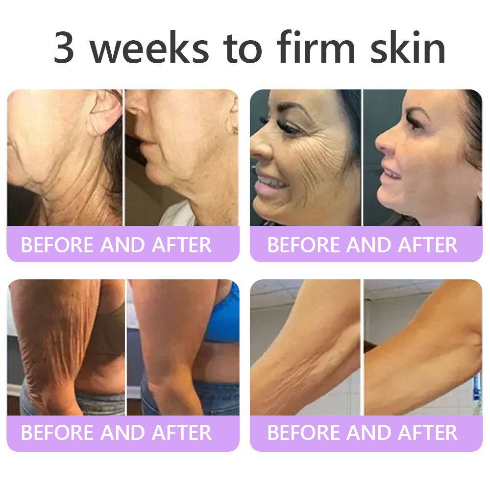 𝐃𝐞𝐫𝐦𝐚𝐭𝐨𝐥𝐨𝐠𝐢𝐬𝐭-𝐑𝐞𝐜𝐨𝐦𝐦𝐞𝐧𝐝𝐞𝐝 👩‍⚕️|💎 𝑽𝒊𝙩𝙖l𝗶𝘀𝐲𝐬® 𝙋𝘿𝙍𝙉 𝙈𝙪𝙡𝙩𝙞-𝙋𝙚𝙥𝙩𝙞𝙙𝙚 𝑴𝒂𝒔𝒔𝒂𝒈𝒊𝒏𝒈 𝑩𝒐𝒅𝒚 𝑹𝒐𝒍𝒍𝒆𝒓 𝑪𝒓𝒆𝒂𝒎- 𝑨𝒏𝒕𝒊-𝒂𝒈𝒊𝒏𝒈, 𝐇𝐲𝐝𝐫𝐚𝐭𝐢𝐧𝐠, 𝐒𝐤𝐢𝐧 𝐅𝐢𝐫𝐦𝐢𝐧𝐠 & 𝐋𝐢𝐟𝐭𝐢𝐧𝐠, 𝗦𝗸𝗶𝗻 𝗥𝗲𝗽𝗮𝗶𝗿, 𝗘𝘃𝗲𝗻 𝗧𝗼𝗻𝗲, 𝗔𝗰𝗻𝗲 𝗮𝗻𝗱 𝗗𝗮𝗿𝗸 𝗦𝗽𝗼𝘁 𝗧𝗿𝗲𝗮𝘁𝗺𝗲𝗻𝘁, 𝗪𝗮𝗿𝘁 𝗮𝗻𝗱 𝗠𝗼𝗹𝗲 𝗥𝗲𝗺𝗼𝘃𝗮𝗹, 𝗮𝗻𝗱 𝗣𝘀𝗼𝗿𝗶𝗮𝘀𝗶𝘀 𝗥𝗲𝗹𝗶𝗲𝗳.