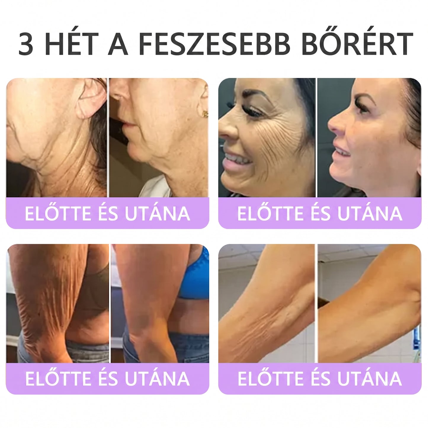 Bőrgyógyászok által ajánlott👩‍⚕️ |🥇 Vitalisys® PDRN Multi-Peptide Masszírozó Testápoló Krém – Öregedésgátló, hidratáló, feszesítő, bőrregeneráló, egységesítő, pattanás- és folteltávolító, szemölcs- és anyajegy-eltávolító, pikkelysömör enyhítő.🍇
