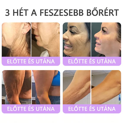 Bőrgyógyászok által ajánlott👩‍⚕️ |🥇 Vitalisys® PDRN Multi-Peptide Masszírozó Testápoló Krém – Öregedésgátló, hidratáló, feszesítő, bőrregeneráló, egységesítő, pattanás- és folteltávolító, szemölcs- és anyajegy-eltávolító, pikkelysömör enyhítő.🍇