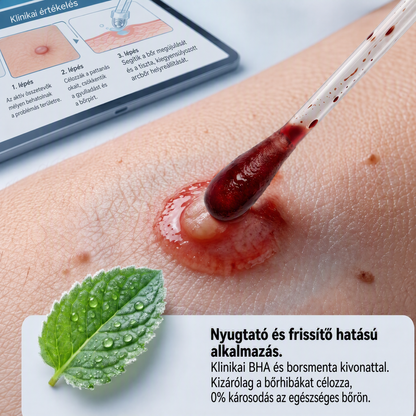Autoryzowany sklep flagowy 🌿|🌥️ Vitalisys® 7-dniowy korektor do usuwania znamion i plam (rolka do usuwania bez bólu i bez blizn) 💟