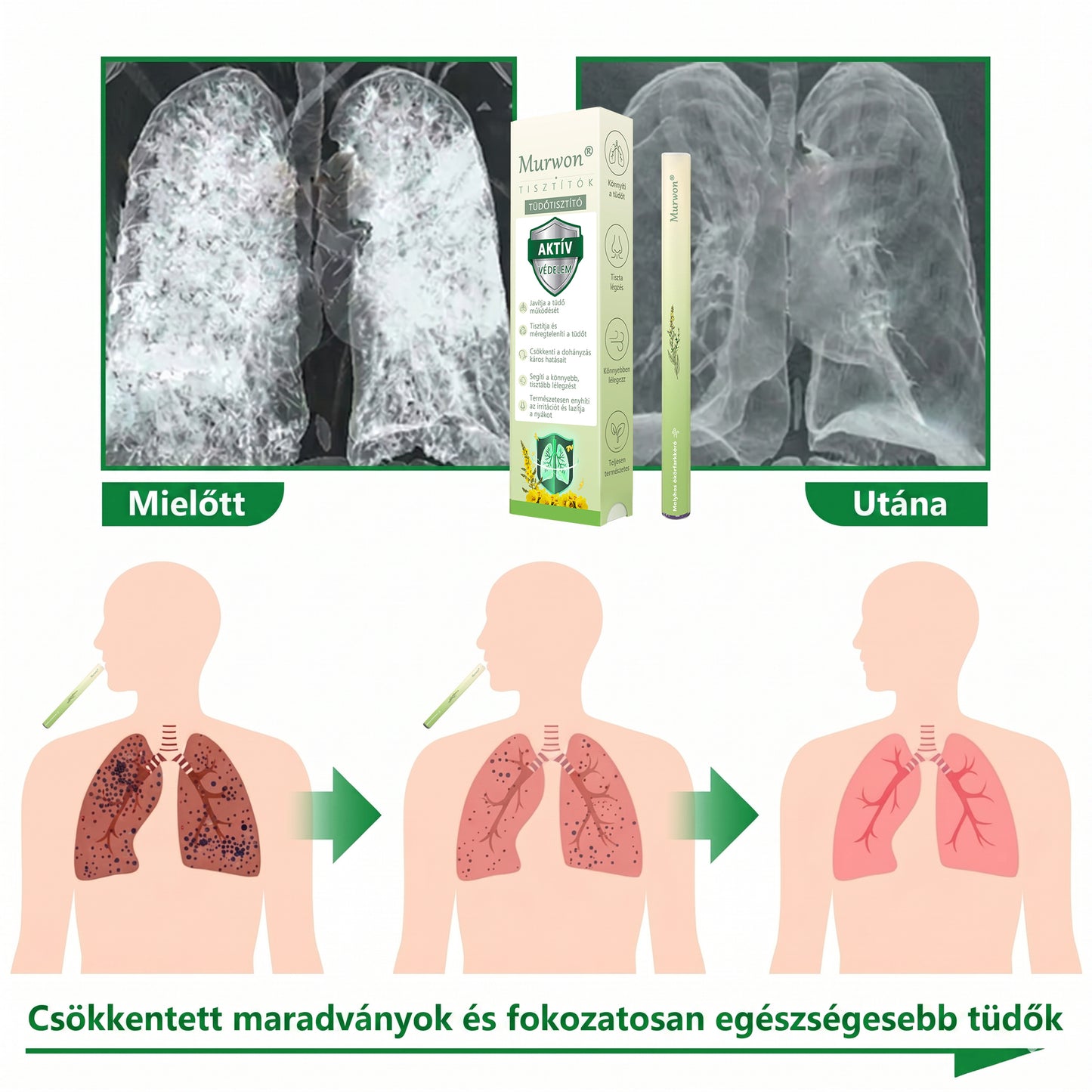 🇭🇺 𝐇𝐢𝐯𝐚𝐭𝐚𝐥𝐨𝐬 𝐖𝐞𝐛á𝐫𝐮𝐡á𝐳✅ 𝑀𝐮𝒓𝒘𝒐𝒏® gyógynövényes tüdőtisztító párologtató👑(👨‍⚕️Hatékony segítség: köhögés, torokgyulladás, légszomj, váladékképződés, orrdugulás, hörghurut, allergiás tünetek és tüdőpanaszok esetén)2💝