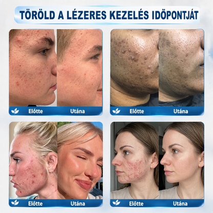 Autoryzowany sklep flagowy 🌿|🌥️ Vitalisys® 7-dniowy korektor do usuwania znamion i plam (rolka do usuwania bez bólu i bez blizn) 💟