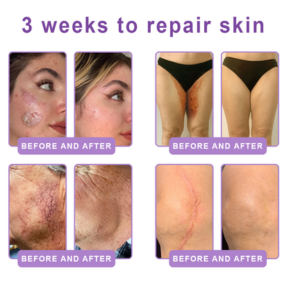 𝐃𝐞𝐫𝐦𝐚𝐭𝐨𝐥𝐨𝐠𝐢𝐬𝐭-𝐑𝐞𝐜𝐨𝐦𝐦𝐞𝐧𝐝𝐞𝐝 👩‍⚕️|💎 𝑽𝒊𝙩𝙖l𝗶𝘀𝐲𝐬® 𝙋𝘿𝙍𝙉 𝙈𝙪𝙡𝙩𝙞-𝙋𝙚𝙥𝙩𝙞𝙙𝙚 𝑴𝒂𝒔𝒔𝒂𝒈𝒊𝒏𝒈 𝑩𝒐𝒅𝒚 𝑹𝒐𝒍𝒍𝒆𝒓 𝑪𝒓𝒆𝒂𝒎- 𝑨𝒏𝒕𝒊-𝒂𝒈𝒊𝒏𝒈, 𝐇𝐲𝐝𝐫𝐚𝐭𝐢𝐧𝐠, 𝐒𝐤𝐢𝐧 𝐅𝐢𝐫𝐦𝐢𝐧𝐠 & 𝐋𝐢𝐟𝐭𝐢𝐧𝐠, 𝗦𝗸𝗶𝗻 𝗥𝗲𝗽𝗮𝗶𝗿, 𝗘𝘃𝗲𝗻 𝗧𝗼𝗻𝗲, 𝗔𝗰𝗻𝗲 𝗮𝗻𝗱 𝗗𝗮𝗿𝗸 𝗦𝗽𝗼𝘁 𝗧𝗿𝗲𝗮𝘁𝗺𝗲𝗻𝘁, 𝗪𝗮𝗿𝘁 𝗮𝗻𝗱 𝗠𝗼𝗹𝗲 𝗥𝗲𝗺𝗼𝘃𝗮𝗹, 𝗮𝗻𝗱 𝗣𝘀𝗼𝗿𝗶𝗮𝘀𝗶𝘀 𝗥𝗲𝗹𝗶𝗲𝗳.