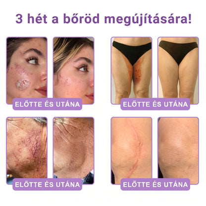Bőrgyógyászok által ajánlott👩‍⚕️ |🥇 Vitalisys® PDRN Multi-Peptide Masszírozó Testápoló Krém – Öregedésgátló, hidratáló, feszesítő, bőrregeneráló, egységesítő, pattanás- és folteltávolító, szemölcs- és anyajegy-eltávolító, pikkelysömör enyhítő.🍇