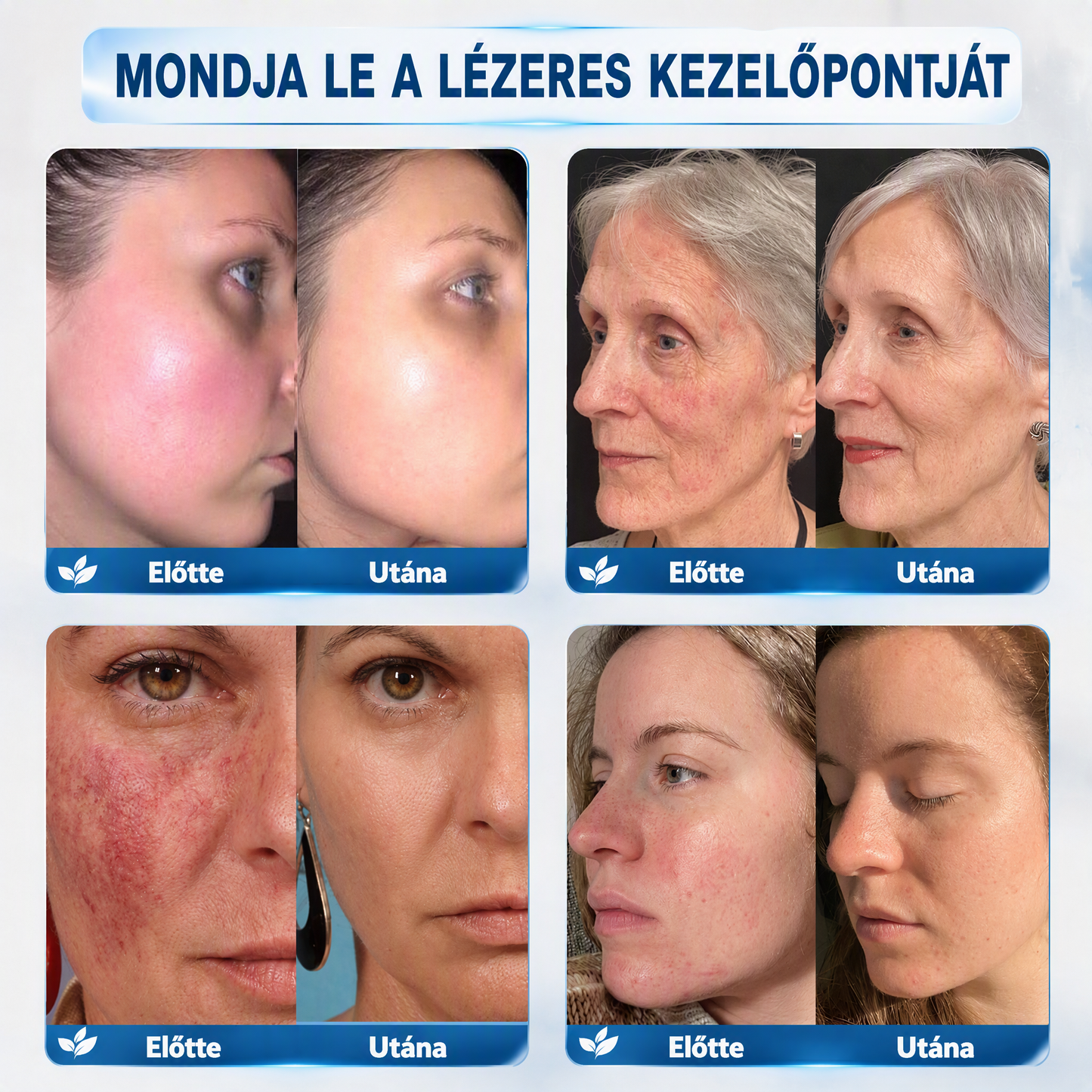 Autoryzowany sklep flagowy 🌿|🌥️ Vitalisys® 7-dniowy korektor do usuwania znamion i plam (rolka do usuwania bez bólu i bez blizn) 💟