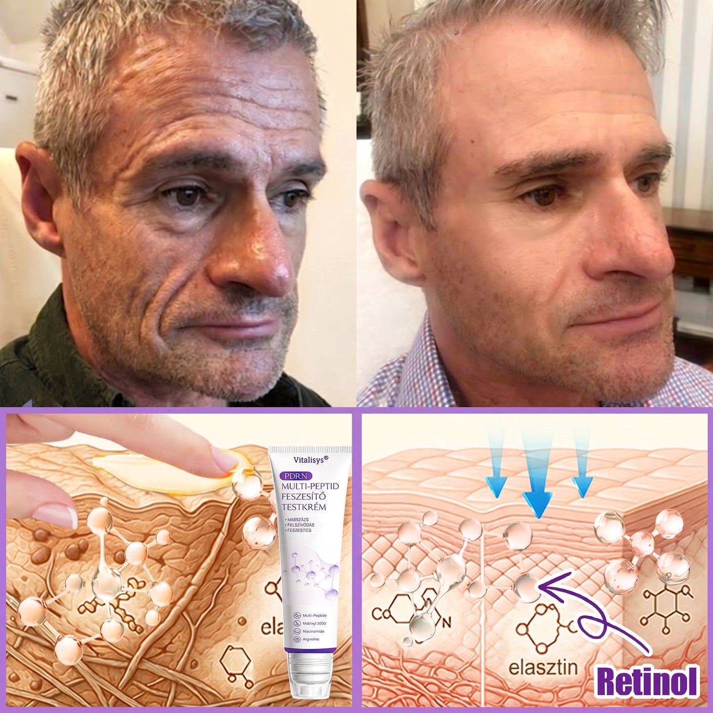 Bőrgyógyászok által ajánlott👩‍⚕️ |🥇 Vitalisys® PDRN Multi-Peptide Masszírozó Testápoló Krém – Öregedésgátló, hidratáló, feszesítő, bőrregeneráló, egységesítő, pattanás- és folteltávolító, szemölcs- és anyajegy-eltávolító, pikkelysömör enyhítő.🍇